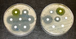 Traditional testing of antibiotics in vitro. Image credit: Graham Beards